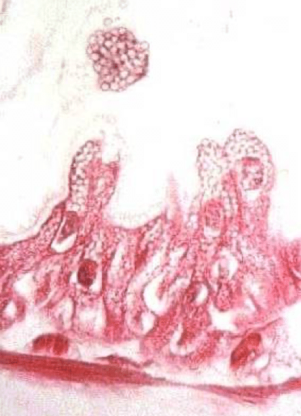 Enfermedades en la colmena: Nosemosis - Apicultura